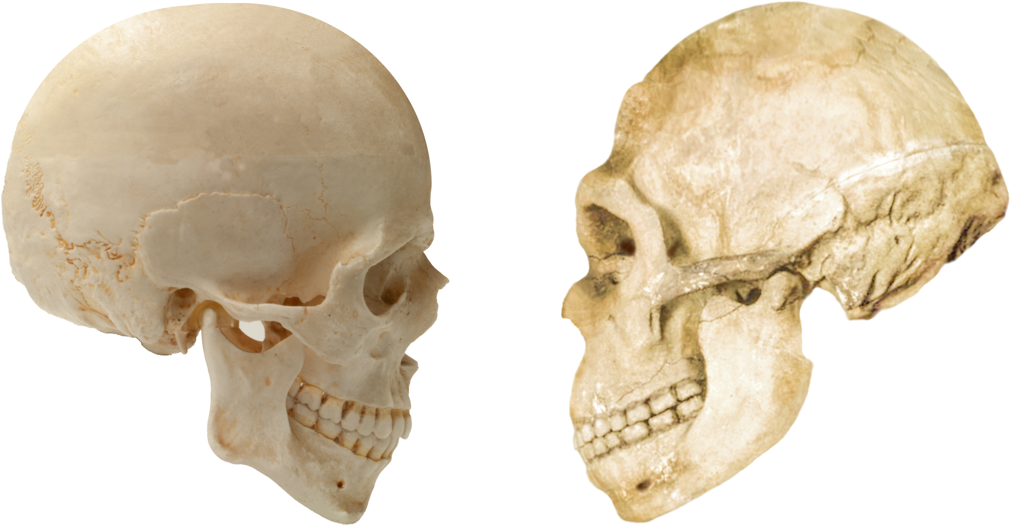 Two-Skulls-Modern--Ancient-V2Fabulous Teeth & Ron Winter dental anatomy  ron winter of fabulous teeth @ seaside dental laboratory & clinic Takapuna Auckland New Zealand.jpg 