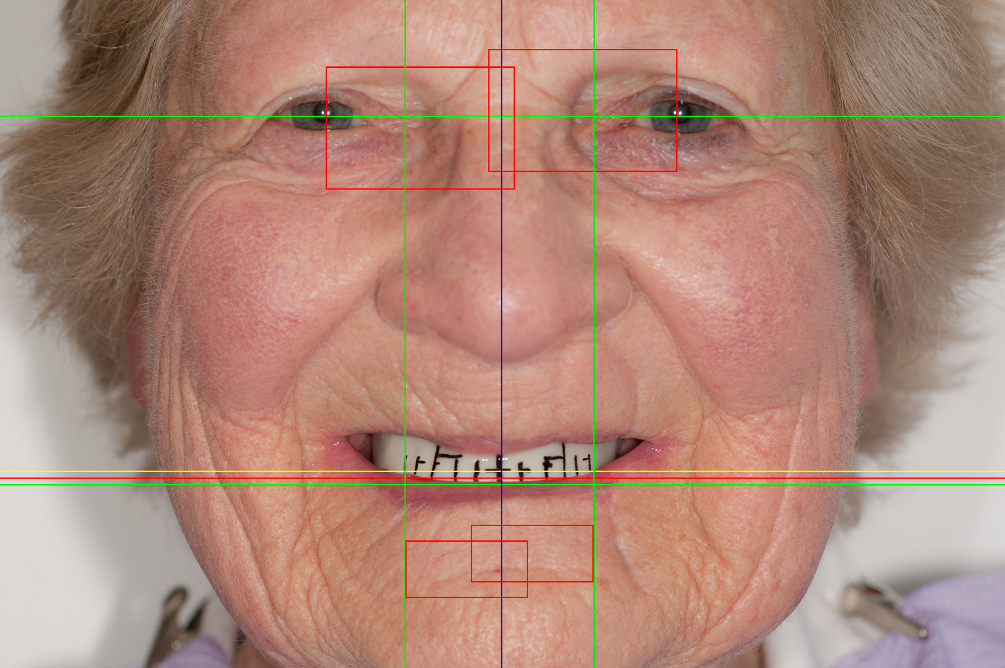 _RCW2588-Facial-Photo-analysis-vIIPhoto Realistic Diagnosis.jpg
