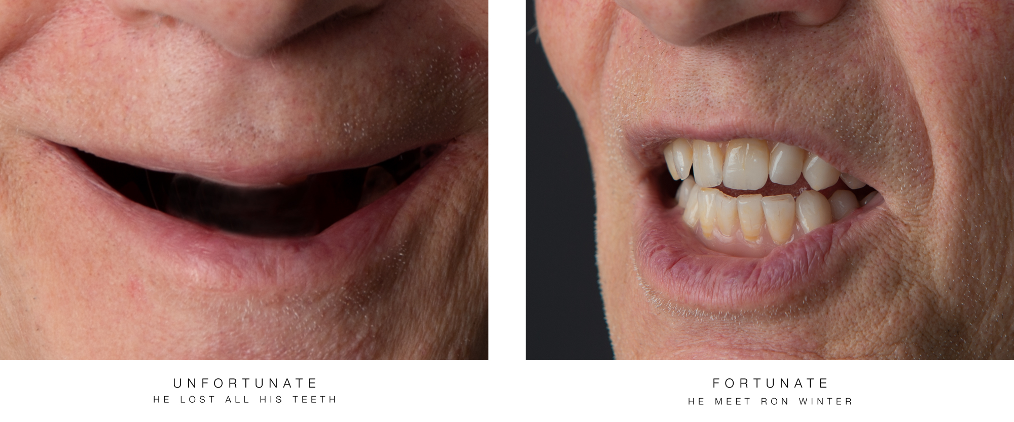 A-fortunate-Man by Ron Winter of Fabulous Teeth @ Seaside Dental Laboratory & Clinic.jpg
