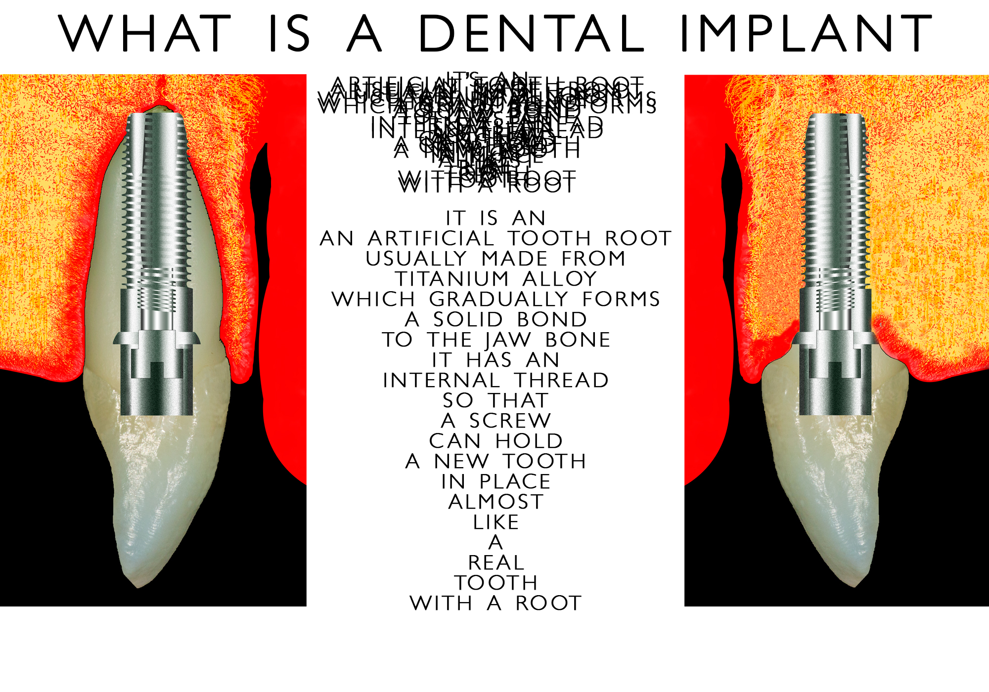 Implant-Explination-Messy-One.jpg