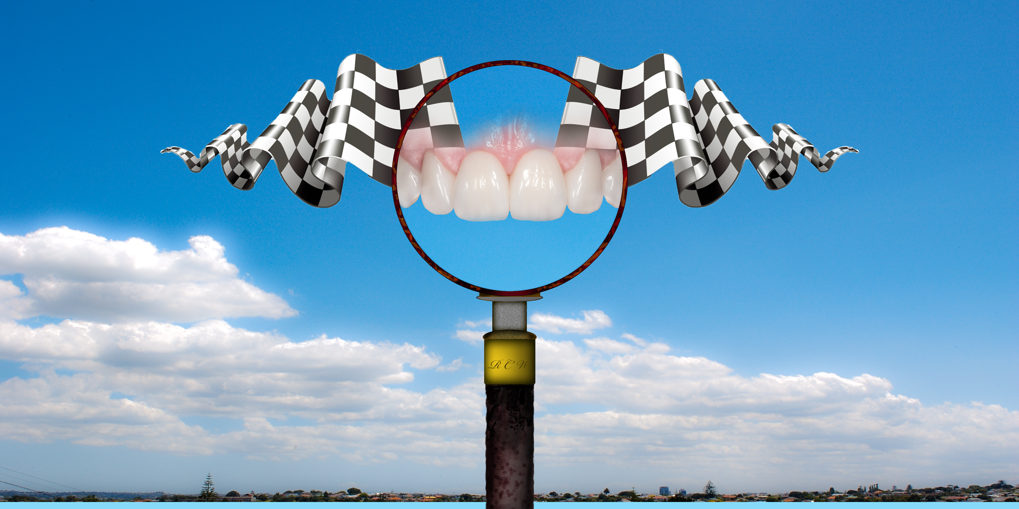 Finishing-Flags-V1ron winter of fabulous teeth @ seaside dental laboratory & clinic Takapuna Auckland New Zealand.jpg